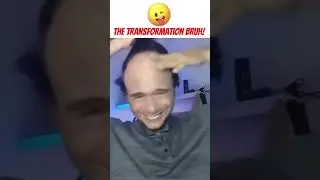 Funny Shorts Transformation #funny #epicfail #shorts #comedy #tiktok 🫢😮😂