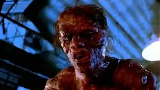 The Fly 1986 Loosing Teeth Scene