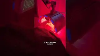 Рассказываем о популярной процедуре ФДТ. #shorts