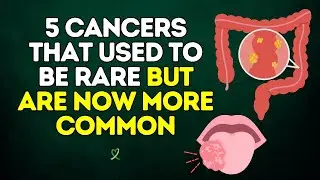 5 Cancers That Used to Be Rare but Are Becoming More Common