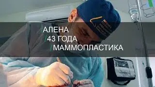 Мне стало легче, во всех отношениях. Уменьшение груди. История Алены