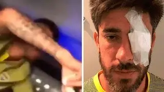 Bus De Boca En El Momento Del Ataque - Conmebol Libertadores Gran Final