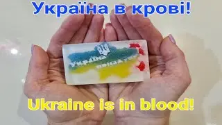 Україна в крові! Ukraine is in blood!