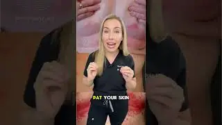 How to fix this red, itchy rash in skin folds called….INTERTRIGO!  