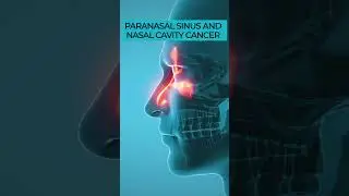 Paranasal Sinus & Nasal Cavity Cancer: Head and Neck Cancer Explained 🎗️🩺