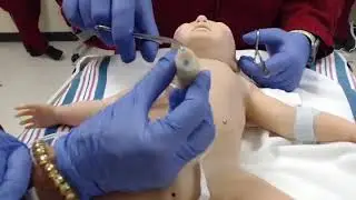 Emergency Umbilical Vein (UVC) Line Insertion