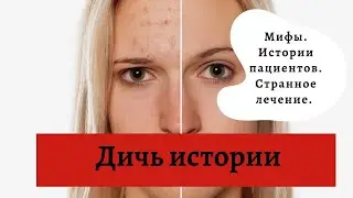 МИФЫ В КОСМЕТОЛОГИИ И ДЕРМАТОЛОГИИ #ДИЧЬИСТОРИИ (Прямой эфир)