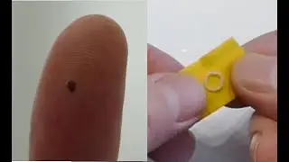 Remove Warts with Apple Cider Vinegar, 100% Effective!!!