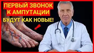 5 SIGNS Your Leg Arteries Are Dying (Check Now)