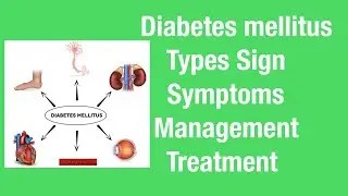 Diabetes,Types,Symptoms,Medicine,management