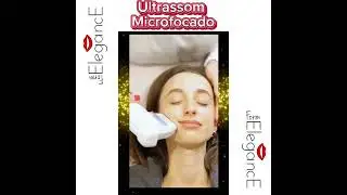 Cópia de Cópia de Cópia de Cópia de Cópia de preenchimento facial   feminino