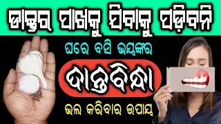 ଘରେ ବସି ଭୟଙ୍କର ଦାନ୍ତବିନ୍ଧା (Toothache) ରୁ ୫ ମିନିଟରେ ଆରାମ ପାଆନ୍ତୁ  | Home Remedies for Tooth Pain