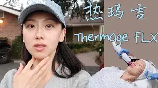 【Anna阿姨 医美vlog#3】我去做了第二次热玛吉 | 医美分享Thermage FLX | 美国旧金山湾区 找诊所 咨询 过程体验