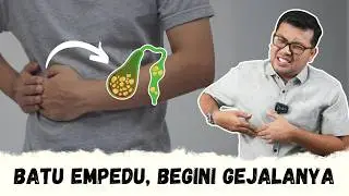 Gejala batu empedu yang sering tidak di sadari- DOKTER SADDAM ISMAIL