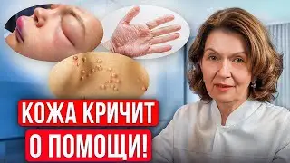 ДИАГНОСТИКА по коже. ПРОСТО и наглядно.