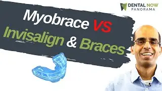 Myobrace compared to Braces and Invisalign | Dentist Explained (2021)