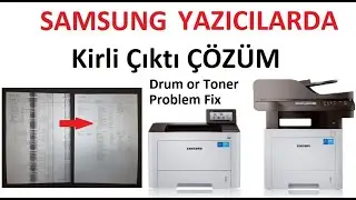 SAMSUNG 4020 4025 3815 4075 Kirli Yazdırma Problemi Drum ünitesi veya Toner ile Çözüm