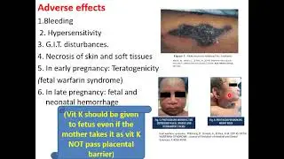 Anticoagulant part 2(pharmacology)