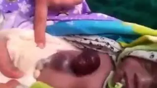 Тажикстанда жүрөгү сыртында жайгашкан наристе төрөлдү. Нерви жукалар көрүүгө болбойт.