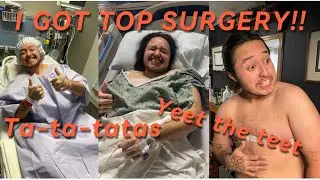 I GOT TOP SURGERY!!