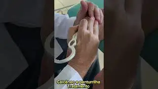 Panturrilha e Tornozelo - Tratamento