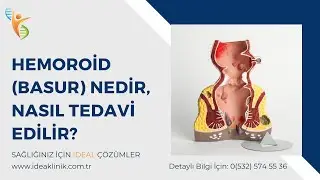 Hemoroid (Basur) Nedir, Nasıl Tedavi Edilir? - IDEA Klinik