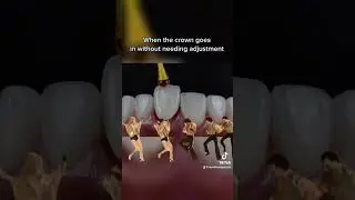 CAD CAM dentistry Oceanside