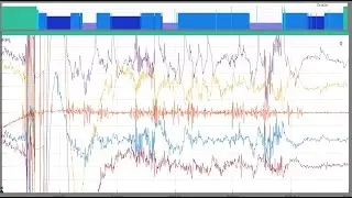 FASST-Z3Score - One Click Automatic Sleep Scoring