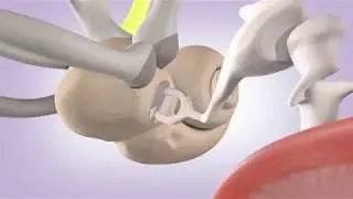 Ear Bones
