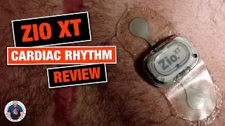 Zio XT Patch Review Cardiac Rhythm Monitor