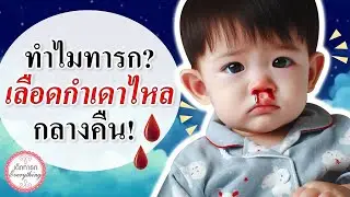 อาการทารก : ทารกเลือดกำเดาไหลตอนกลางคืน คืออะไร? | อาการเด็กทารก | เด็กทารก Everything