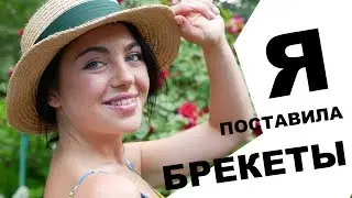 🦷 Я ПОСТАВИЛА БРЕКЕТЫ / БОЛЬНО ЛИ СТАВИТЬ БРЕКЕТЫ / Таня Гарюк