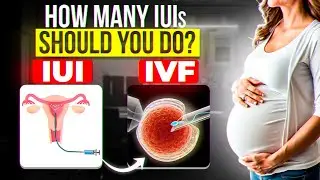 How many IUI cycles should you do?