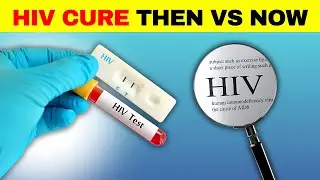 The Evolution of HIV Cure Treatment: From the 80s to Today