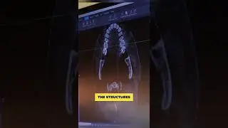 Dentistry filming: cold beam X-Ray    #dentistry #dental #dentist