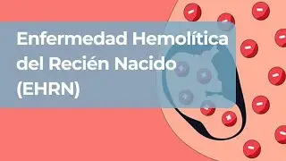 Anemia Hemolítica, Hipersensibilidad tipo II e Ictericia Pre-Hepatica
