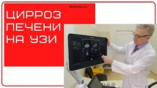 Цирроз печени на УЗИ брюшной полости