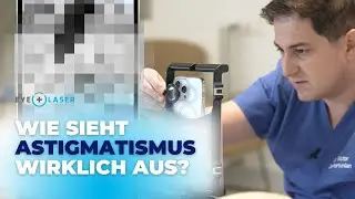 Wie sieht Astigmatismus wirklich aus? Ein visueller Leitfaden für Sie I Eyelaser Wien & Zürich
