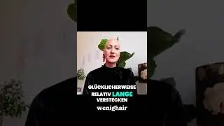 Alopecia: Verbergen, Verdrängen & Akzeptieren #alopezie #kreisrunderhaarausfall #wenighair