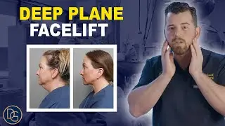 Deep Plane Facelift: Modern Facial Rejuvenation Surgery