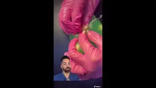 Rating pops (part 2) @ASMR W Bri🫶🏻  #dermdoctor #shorts