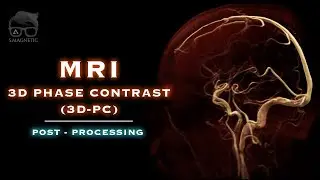 MRI 3D PHASE CONTRAST (3D-PC) – POST-PROCESSING