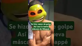 Así luce la máscara que usa Kylian Mbappé tras su lesión en la nariz