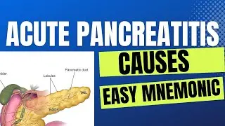Acute Pancreatitis | Causes | Easy Mnemonic