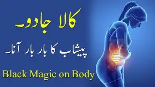 Kala Jadu (Pishab ka Bar Bar ana aur Illaj) Black Magic on Body