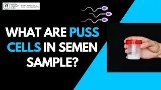The Truth about Pus Cells in Semen Samples | What You Need to Know and When to Take Action?