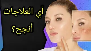 شنو اللي كيخلي العلاج ينجح؟المنتوجات الاقتصادية أو الباهظة🤔وصفات طبيعية ام علاج كيميائي🧐