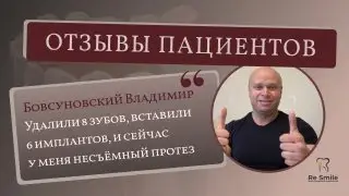 ОТЗЫВ Бовсуновского Владимира. ПРОБЛЕМА: частичное отсутствие и СИЛЬНАЯ ПОДВИЖНОСТЬ ЗУБОВ.
