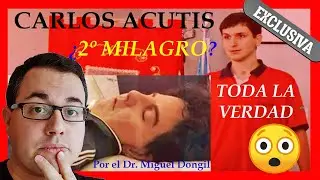 SEGUNDO MILAGRO de CARLO ACUTIS ¿😱? 2 Milagro de Carlo Acutis