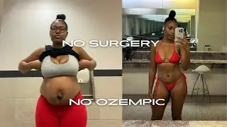 How Long Does It Take to Heal Diastasis Recti? Realistic Expectations